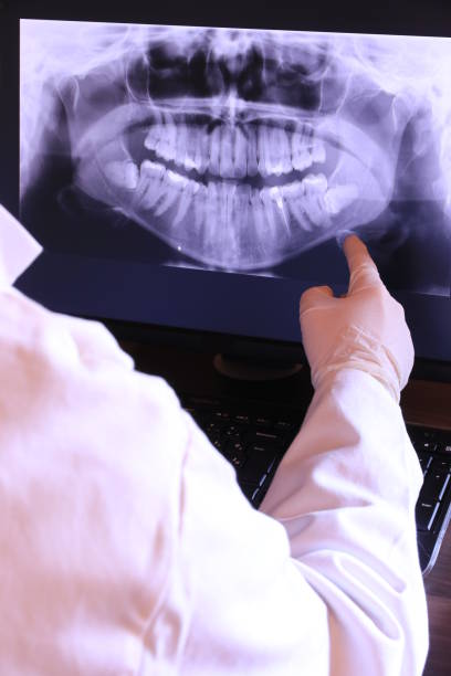 Best Emergency Treatment for Dental Infections or Abscesses in Pelzer, SC